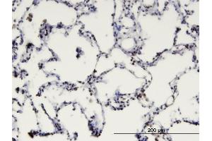 Immunoperoxidase of monoclonal antibody to MBD1 on formalin-fixed paraffin-embedded human lung.