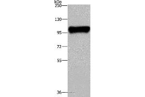 Western blot analysis of Raji cell, using PTK2B Polyclonal Antibody at dilution of 1:300