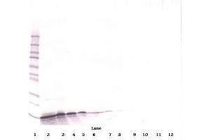 Image no. 3 for anti-gamma-Interferon-Induced Monokine (CXCL9) antibody (ABIN465139) (CXCL9 anticorps)