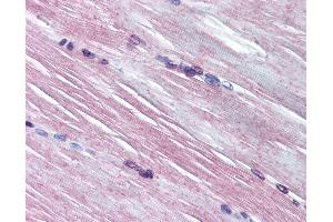 Anti-AMPD1 antibody IHC of human skeletal muscle. (AMPD1 anticorps  (AA 140-190))