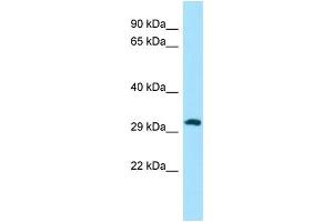 Host: Rabbit Target Name: PIH1D1 Sample Type: A549 Whole Cell lysates Antibody Dilution: 1. (PIH1D1 anticorps  (C-Term))