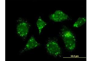 Immunofluorescence of monoclonal antibody to RABGAP1 on HeLa cell. (RABGAP1 anticorps  (AA 1-110))