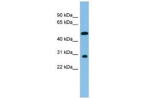 WB Suggested Anti-HOXC8 Antibody Titration: 0.