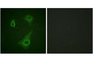 Immunofluorescence analysis of HepG2 cells, using Epo-R (Phospho-Tyr368) Antibody. (EPOR anticorps  (pTyr368))