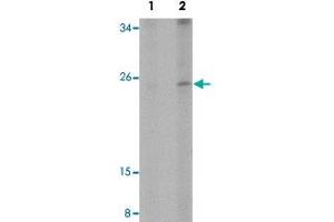 Western blot analysis of human spleen tissue with EFHD1 polyclonal antibody  at (Lane 1) 2 and (Lane 2) 4 ug/mL dilution. (EFHD1 anticorps  (N-Term))