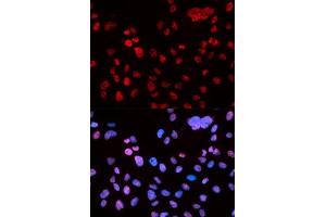 Immunofluorescence analysis of U2OS cell using Phospho-TP53-S9 antibody.