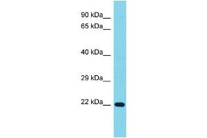 Host: Rabbit Target Name: C1orf158 Sample Type: Jurkat Whole Cell lysates Antibody Dilution: 1. (C1ORF158 anticorps  (N-Term))