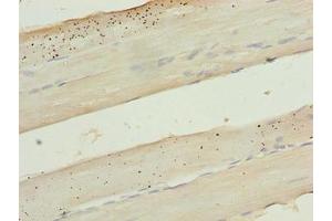 Immunohistochemistry of paraffin-embedded human skeletal muscle tissue using ABIN7157468 at dilution of 1:100