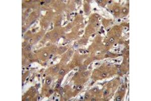 Immunohistochemistry analysis in human liver tissue (Formalin-fixed, Paraffin-embedded) using SPOPL Antibody , followed by peroxidase conjugation of the secondary antibody and DAB staining. (SPOPL anticorps  (Middle Region))
