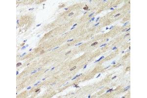 Immunohistochemistry of paraffin-embedded Rat heart using ACSS2 Polyclonal Antibody at dilution of 1:100 (40x lens). (ACSS2 anticorps)
