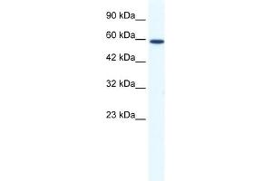 WB Suggested Anti-DDX5 Antibody Titration:  1. (DDX5 anticorps  (N-Term))