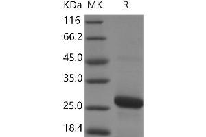 Western Blotting (WB) image for RAB7A, Member RAS Oncogene Family (RAB7A) protein (His tag) (ABIN7321067) (RAB7A Protein (His tag))