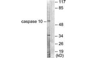 Western blot analysis of extracts from HeLa cells, using Caspase 10 Antibody. (Caspase 10 anticorps  (AA 430-479))