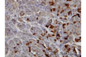 Immunoperoxidase of monoclonal antibody to LAMA2 on formalin-fixed paraffin-embedded human pancreas. (Laminin anticorps  (AA 3013-3122))