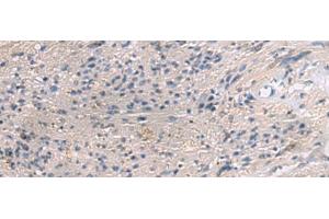 Immunohistochemistry of paraffin-embedded Human brain tissue using PAIP1 Polyclonal Antibody at dilution of 1:80(x200)