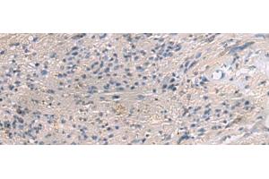 Immunohistochemistry of paraffin-embedded Human brain tissue using PAIP1 Polyclonal Antibody at dilution of 1:80(x200) (PAIP1 anticorps)