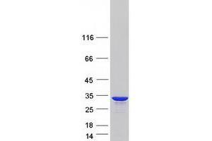 Validation with Western Blot