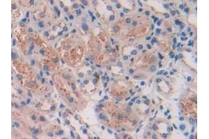 Detection of TPP1 in Mouse Kidney Tissue using Polyclonal Antibody to Tripeptidyl Peptidase I (TPP1)