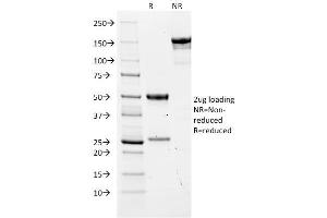 SDS-PAGE Analysis Purified CEA Mouse Monoclonal Antibody (COL-1). (CEACAM5 anticorps)