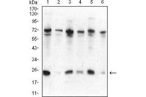 Western blot analysis using CBX5 mouse mAb against Hela (1), NIH/3T3 (2), K562 (3), MCF-7 (4), Jurkat (5), and A431 (6) cell lysate.