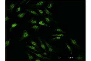 Immunofluorescence of monoclonal antibody to MAP2K2 on HeLa cell.