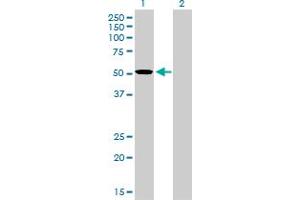 Western Blot analysis of TCF7L2 expression in transfected 293T cell line by TCF7L2 monoclonal antibody (M02), clone 1B1. (TCF7L2 anticorps  (AA 1-455))