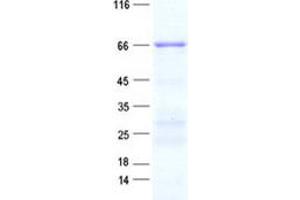 Validation with Western Blot