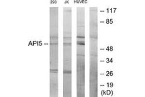 Western Blotting (WB) image for anti-Apoptosis Inhibitor 5 (API5) (AA 421-470) antibody (ABIN2879168) (Apoptosis Inhibitor 5 anticorps  (AA 421-470))