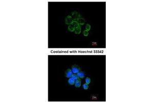 ICC/IF Image Immunofluorescence analysis of methanol-fixed A431, using Citrate synthetase, antibody at 1:200 dilution.