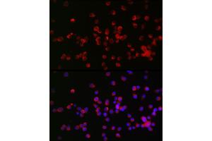 Immunofluorescence analysis of Neuro-2a cells using NOGO Receptor 1 (RTN4R) Rabbit pAb (ABIN6129725, ABIN6147296, ABIN6147297 and ABIN6221547) at dilution of 1:25 (40x lens).