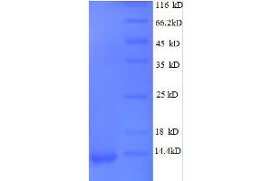Chemokine (C-X-C Motif) Ligand 1 (Melanoma Growth Stimulating Activity, Alpha) (CXCL1) (AA 35-107), (full length) protein (His tag)