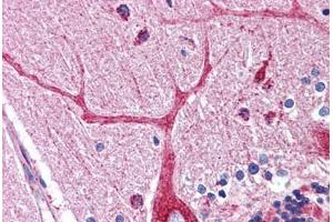 Human Brain, Cerebellum: Formalin-Fixed, Paraffin-Embedded (FFPE) (OCIAD1 anticorps  (C-Term))