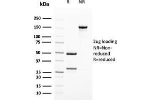 SDS-PAGE Analysis Purified Uroplakin 1B Mouse Monoclonal Antibody (UPK1B/3102). (Uroplakin 1B anticorps  (AA 109-229))