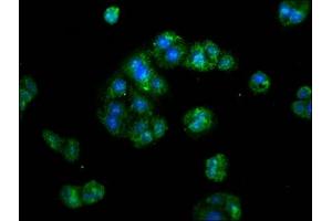 Immunofluorescence staining of HepG2 cells with ABIN7142343 at 1:133, counter-stained with DAPI.