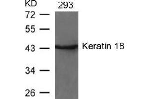 Image no. 2 for anti-Keratin 18 (KRT18) (AA 31-35) antibody (ABIN197581) (Cytokeratin 18 anticorps  (AA 31-35))