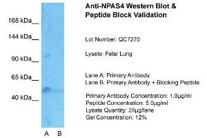 Host:  Rabbit  Target Name:  NPAS4  Sample Type:  Fetal Lung  Lane A:  Primary Antibody  Lane B:  Primary Antibody + Blocking Peptide  Primary Antibody Concentration:  1ug/ml  Peptide Concentration:  5ug/ml  Lysate Quantity:  25ug/lane/Lane  Gel Concentration:  0. (NPAS4 anticorps  (Middle Region))
