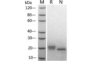 2 μg SCF, Human was resolved with SDS-PAGE under reducing (R) and non-reducing (N) conditions and visualized by Coomassie Blue staining. (KIT Ligand Protein (KITLG))