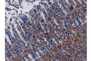 Detection of MCP1 in Rat Stomach Tissue using Polyclonal Antibody to Monocyte Chemotactic Protein 1 (MCP1)