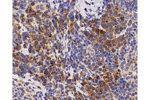 Immunohistochemistry analysis of paraffin-embedded mouse inflammatory spleen using IL2 Polyclonal Antibody at dilution of 1:500. (IL-2 anticorps)