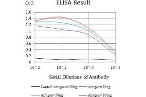 Black line: Control Antigen (100 ng),Purple line: Antigen (10 ng), Blue line: Antigen (50 ng), Red line:Antigen (100 ng)
