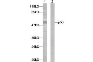 Western blot analysis of extracts from 293 cells treated with (p53 anticorps)