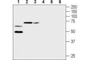 Western blot analysis of rat heart membranes (lanes 1 and 4), mouse brain membranes (lanes 2 and 5) and rat brain membranes (lanes 3 and 6): - 1-3.
