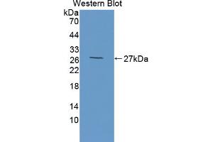 Western blot analysis of the recombinant protein. (HAP1 anticorps  (AA 132-328))