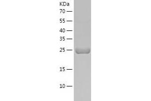 Western Blotting (WB) image for Tryptase alpha/beta 1 (TPSAB1) (AA 35-267) protein (His-IF2DI Tag) (ABIN7123849)