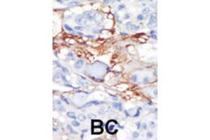 Immunohistochemistry (IHC) image for anti-Platelet-Derived Growth Factor Receptor-Like (PDGFRL) antibody (ABIN3003406) (PDGFRL anticorps)