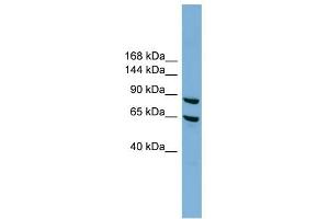 EXOC6 antibody used at 1 ug/ml to detect target protein. (EXOC6 anticorps  (N-Term))