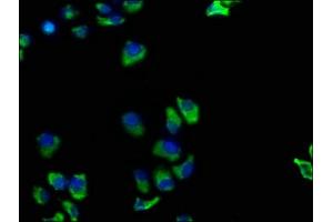Immunofluorescence staining of Hela cells with ABIN7173872 at 1:100, counter-stained with DAPI.