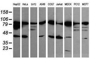 Image no. 1 for anti-Catenin (Cadherin-Associated Protein), beta 1, 88kDa (CTNNB1) antibody (ABIN1496898) (CTNNB1 anticorps)