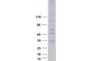 Validation with Western Blot