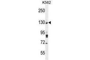 TTBK2 Antibody (N-term) western blot analysis in K562 cell line lysates (35 µg/lane). (TTBK2 anticorps  (N-Term))